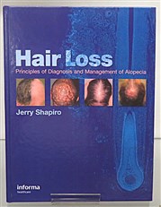 Hair Loss. Principles of Diagnosis and Management of Alopecia 