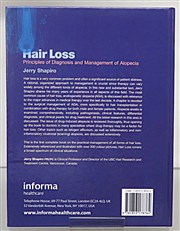 Hair Loss. Principles of Diagnosis and Management of Alopecia 