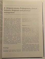 Hair Loss. Principles of Diagnosis and Management of Alopecia 