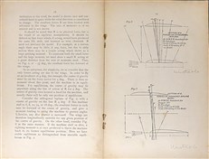 The Triplane and the Stable Biplane